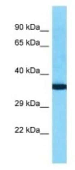OR10K2 Rabbit anti-Human, Polyclonal, Novus Biologicals:Antibodies:Primary